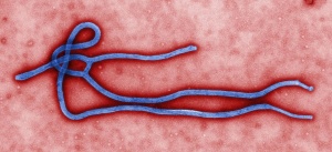1024px-Ebola_virus_virion